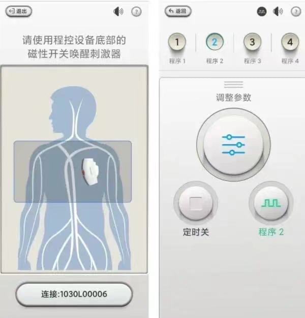 患者端调节界面示意图